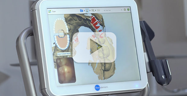 The i-Tero scanner is one of the many types of orthodontic technology used at Milnor Orthodontics in Ft Collins CO