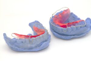 Orthodontic retainers