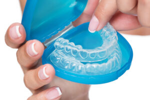 Clean Invisalign aligners