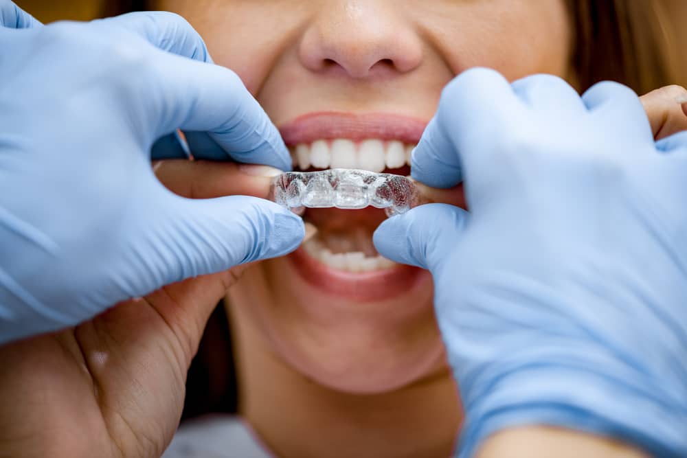 Find the right Invisalign provider, Milnor Orthodontics.