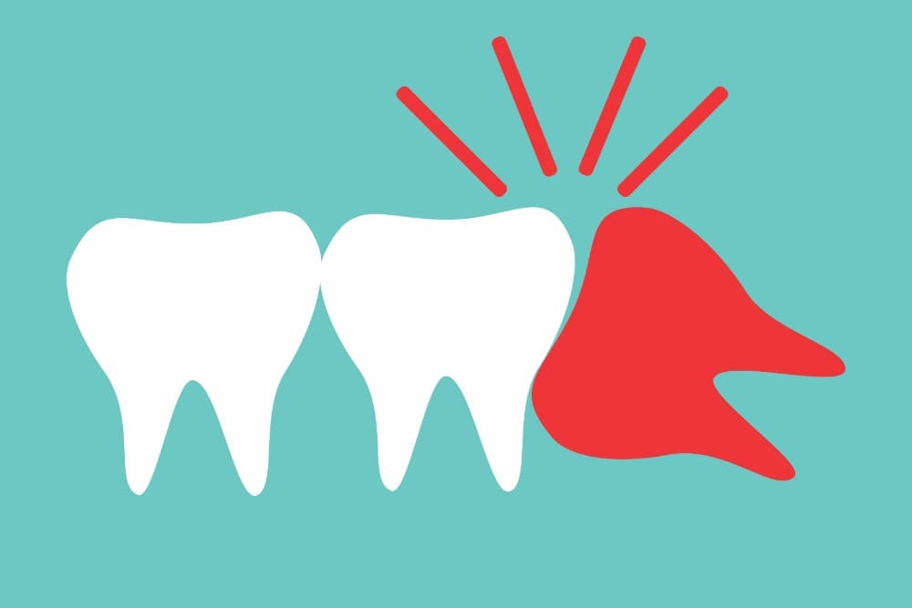 A Ft Collins orthodontist explains how impacted teeth can really damage your smile