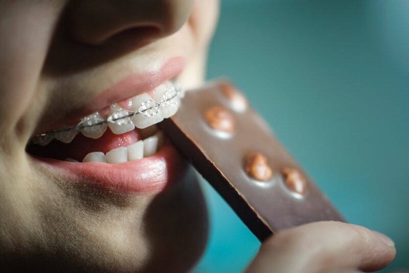 Great Foods for Braces Orthodontist in Ft Collins CO