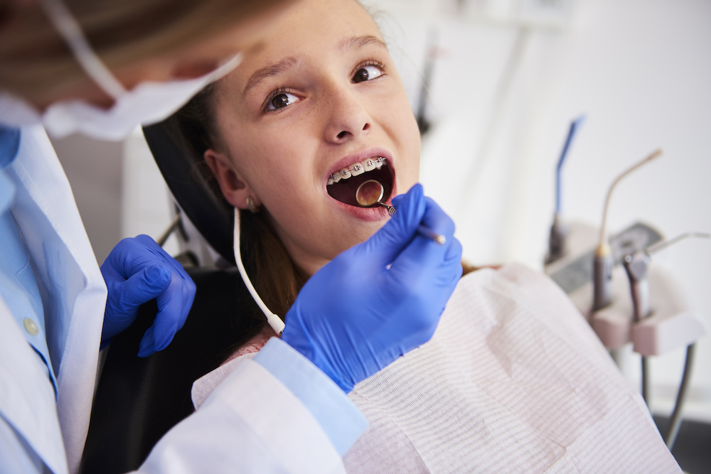 How an Orthodontist Fixes Crowded Teeth With Braces