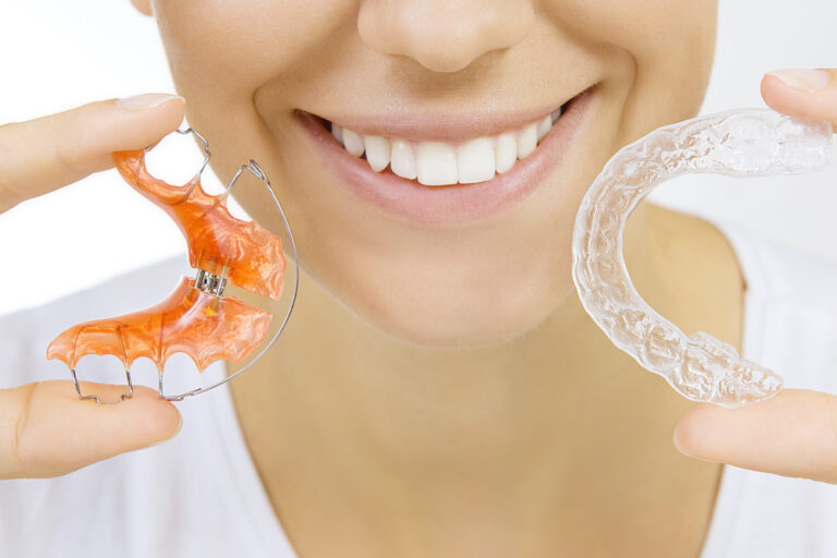 Permanent and Removable Retainers Orthodontist in Fort Collins CO