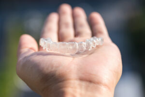 Find out if Invisalign can fix an overbite or underbite from the best orthodontist in Fort Collins CO