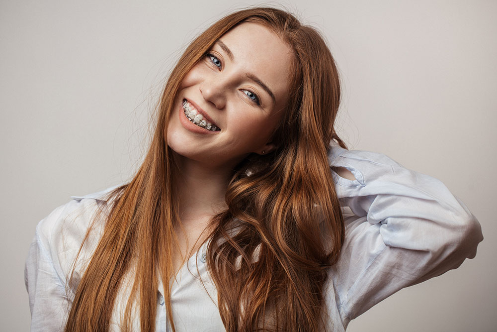What Are Ceramic Braces?  Orthodontist in Fort Collins