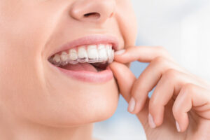 Think You Can't Get Invisalign? Think Again!