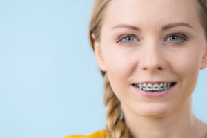 white spots on teeth