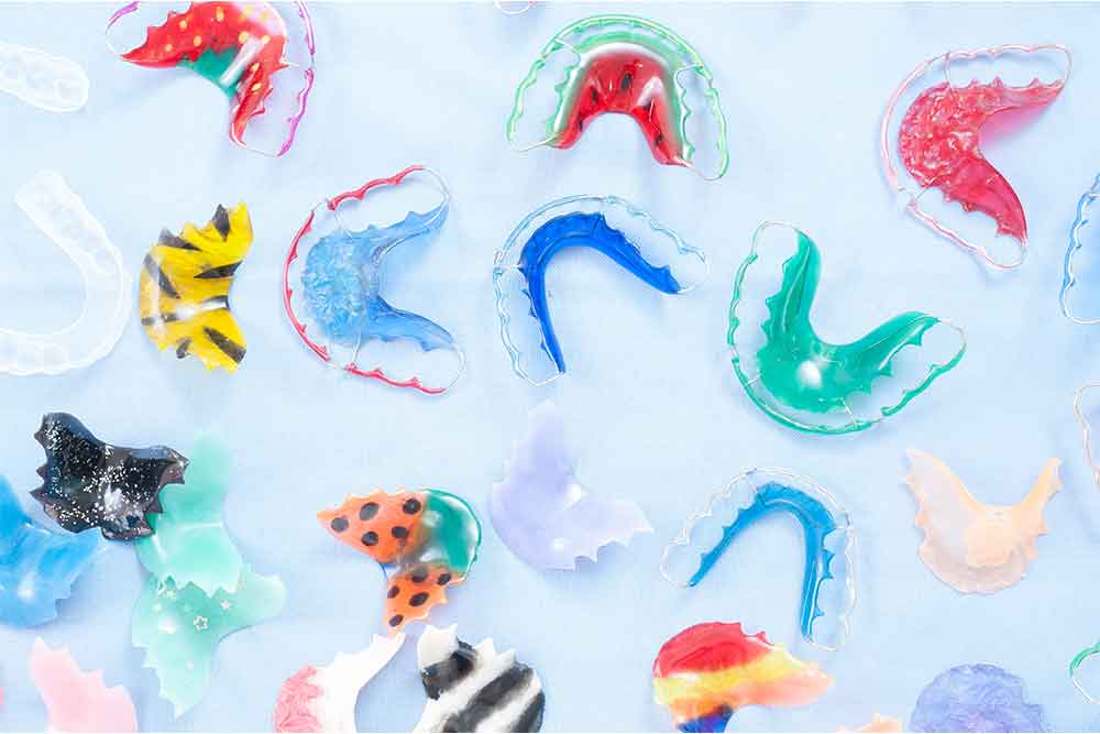 orthodontic-appliances orthodontic appliances