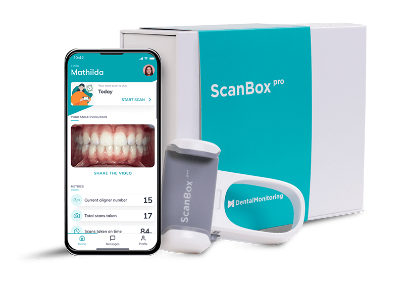 dental monitoring in fort collins co