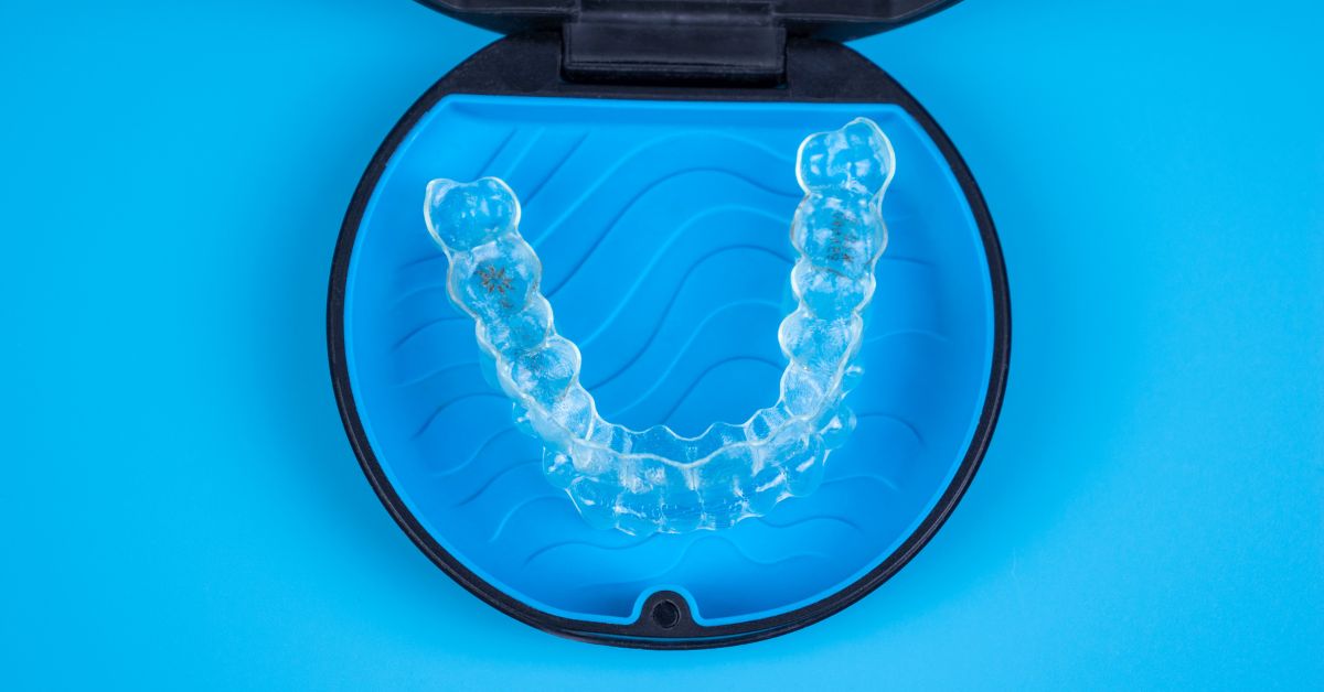The Ultimate Guide To Invisalign - All Your Questions Answered