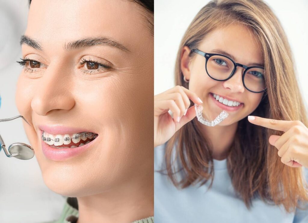 Comparing Invisalign and Braces at Milnor Orthodontics, Fort Collins