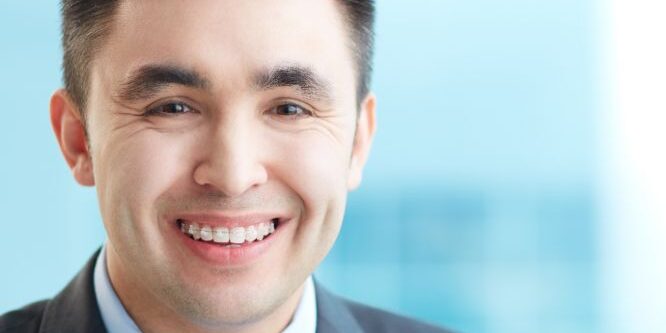 Man with clear ceramic adult braces in Fort Collins, CO