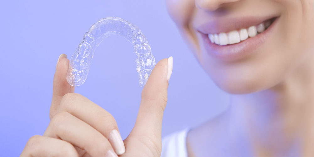 invisalign